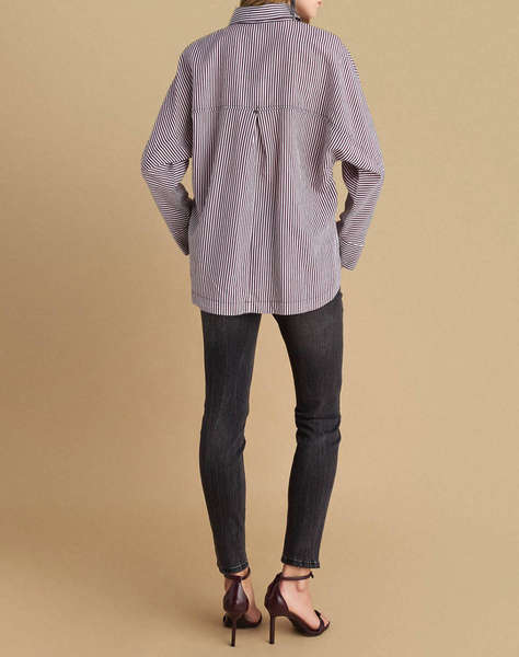 ATTRATTIVO ТУНИКА